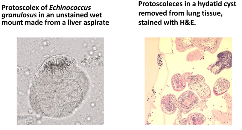 <p>Echinicoccus</p>