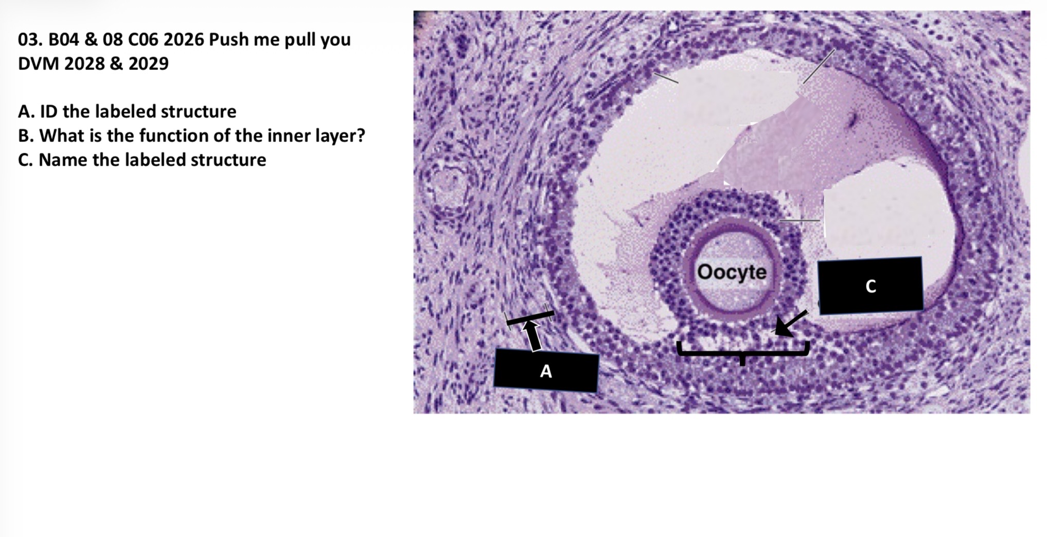 <p>A. ID the labeled structure </p><p>B. What is the function of the inner layer?</p><p>C. Name the labeled structure </p>