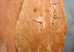 <p>what structure is noted on the inside of the liver?</p>
