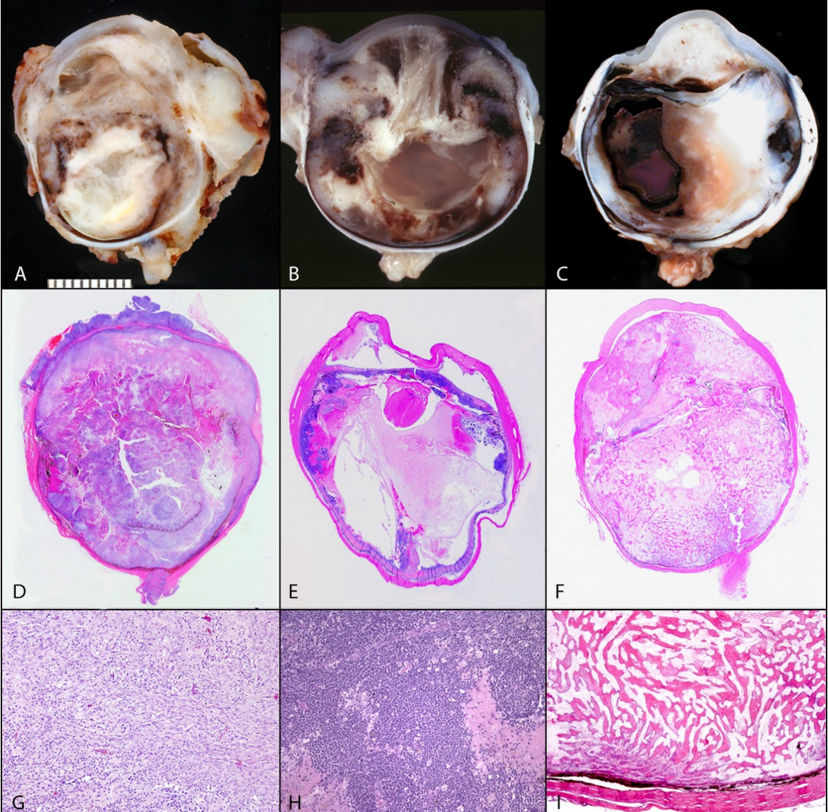 <ul><li><p>lines chambers of the eye, fills globe, extends through sclera, and can invade the optic nerve into the brain</p></li><li><p>may reoccur in orbit after enucleation</p></li><li><p>distant metastasis possible</p></li></ul><p></p>