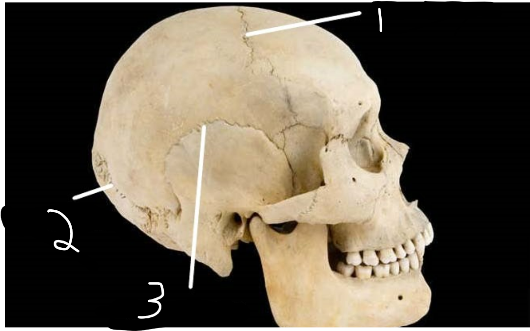<p>where is coronal suture? </p>