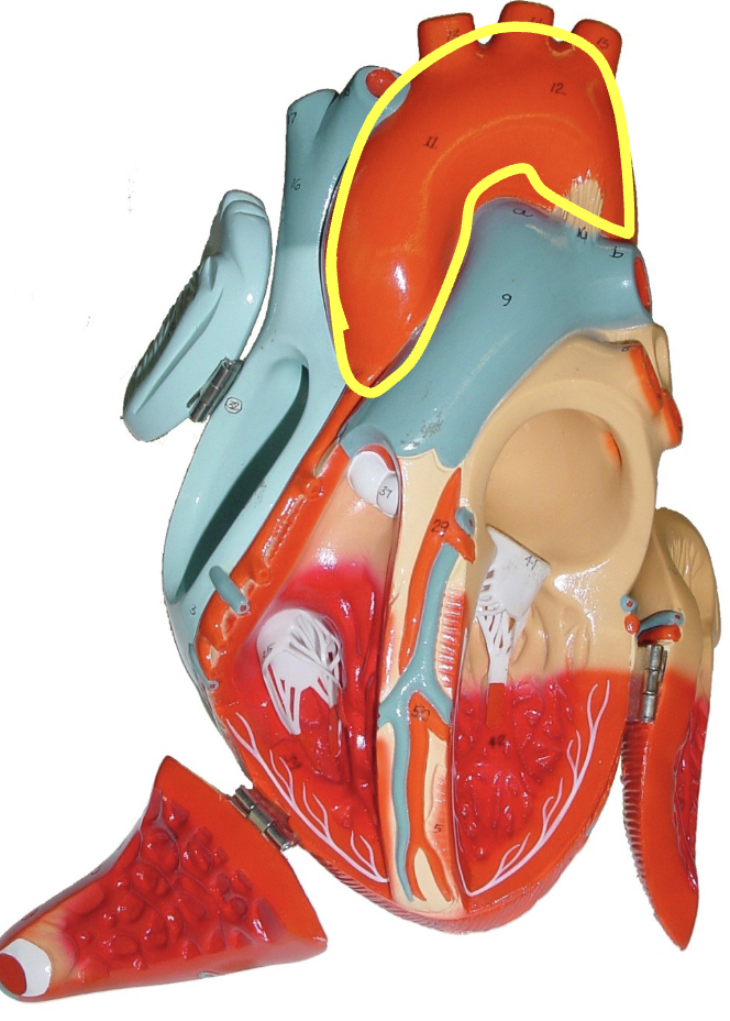 <p>what part of the heart muscle is shown?</p>