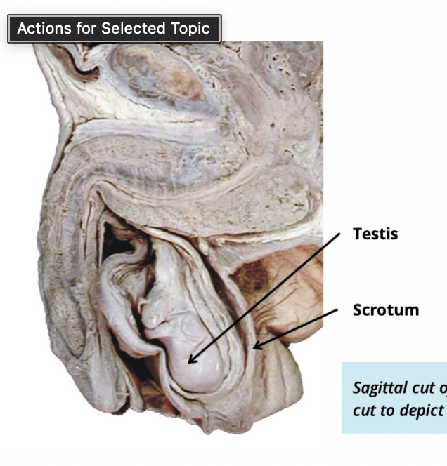 <ul><li><p>sac of skin + fascia surrounding the testes </p></li></ul><p></p>