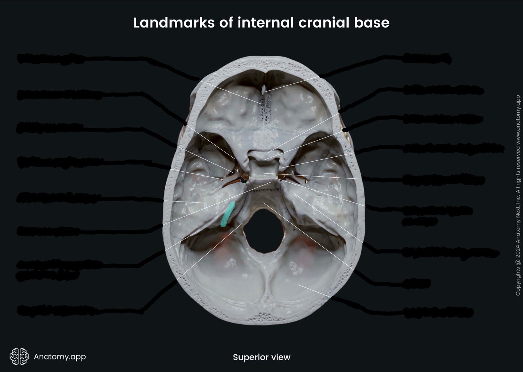 <p>What is the highlighted bony landmark</p>