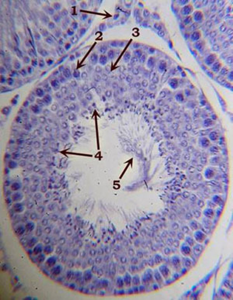 <p>(4) four haploid cells that are formed when a diploid reproductive cell divides meiotically</p>
