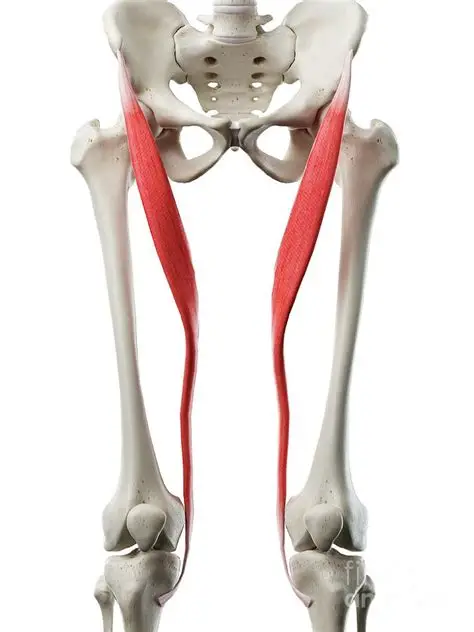 <p>anterior superior iliac spine and notch just below it </p>