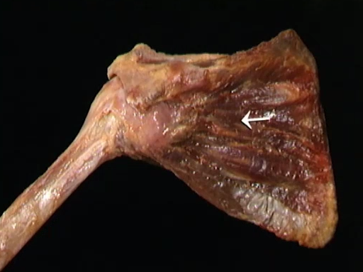 <p>Oppervlakkig, schouder</p>