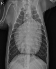 <p>This is a TEXTBOOK case. What are the abnormalities?</p>