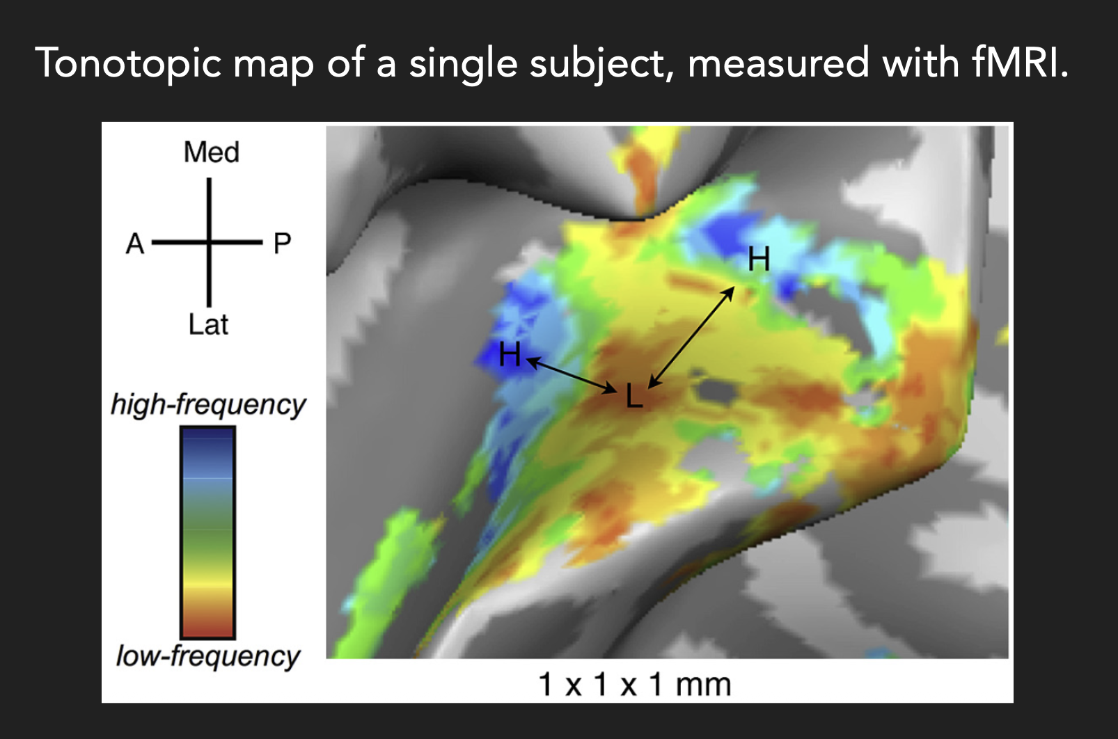 <p>*more selective to higher frequencies as you move away from Heschl’s Gyrus, and more selective to lower frequencies as you get to the centre of Heschl’s Gyrus</p>