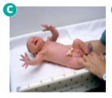 <p>Functie van moro - reflex</p>