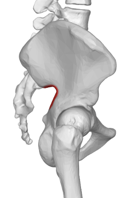 term image