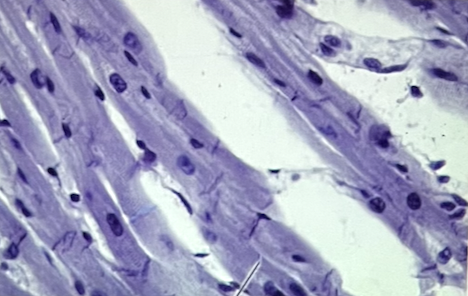 <p>Identify 1 characteristic that describes this muscle tissue</p>