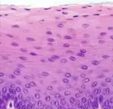 <p>Function of <strong>stratified squamous</strong></p>