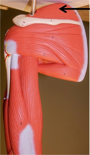 <p>What muscle is this?</p>