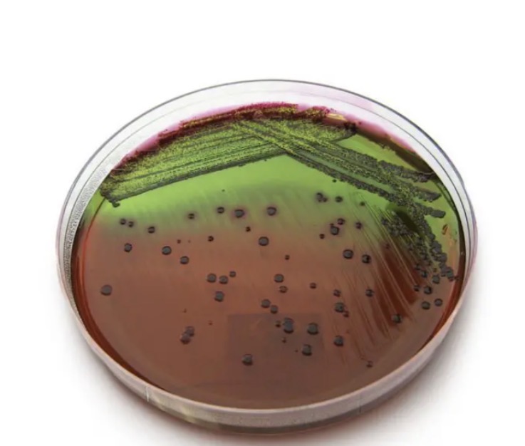 <p>EMB agar</p>