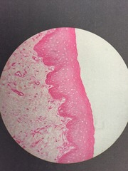 <p>Edge view, layers</p><p>Focusing on the upper deep pink band</p><p>Non-keratinized</p><p>FOUND IN ESOPHAGUS AND SKIN</p>