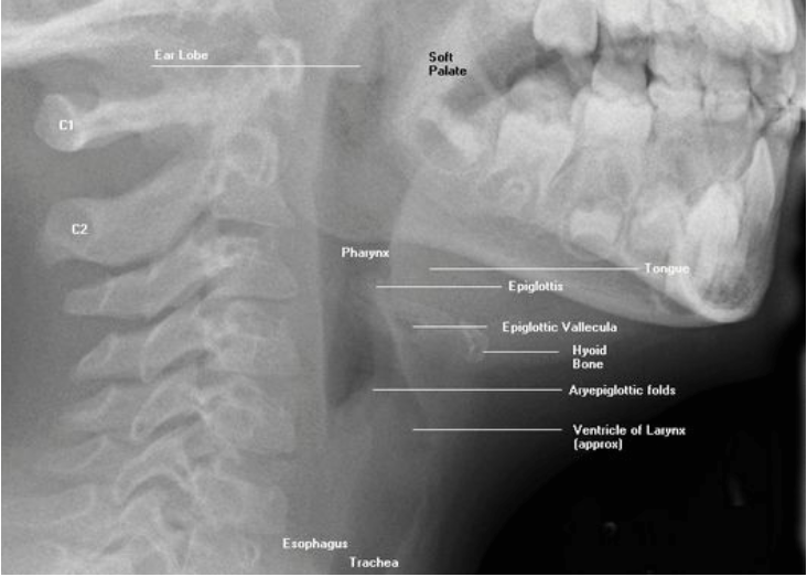 <p>Posterior area between the nose and mouth ( superiorly) and larynx and esophagus ( inferiorly). Serves as passage for food and air. Divided into 3 parts: Naso, oro and laryngopharynx. ( BEST SEEN LATERAL)</p>