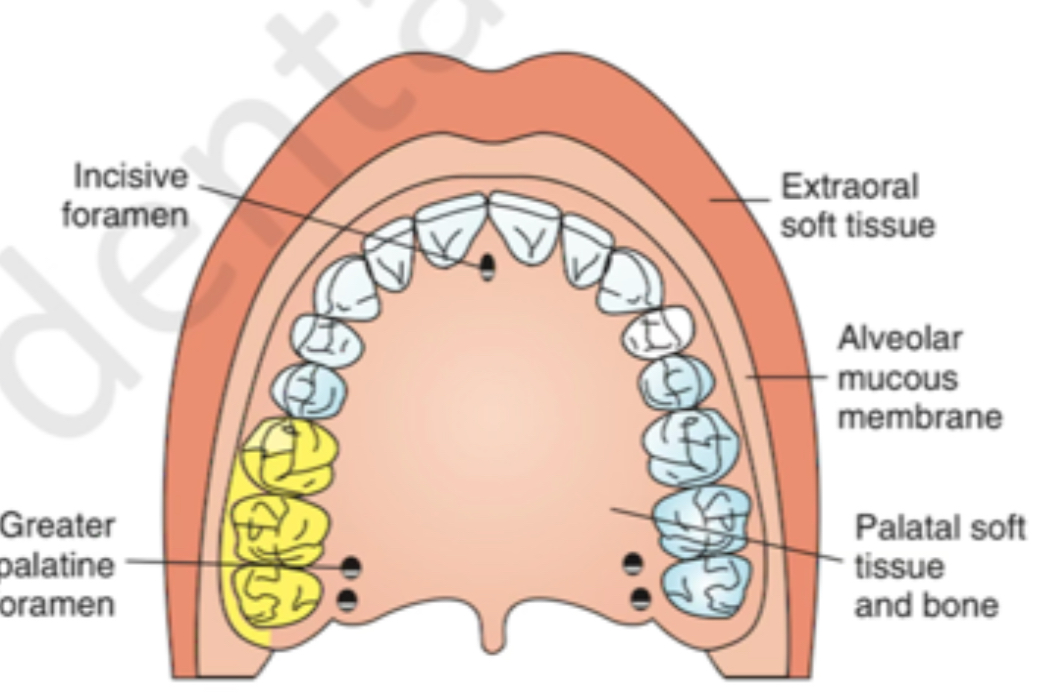 <p>What Nerve block is this? (All molars except MB Toot of 1st Molar)</p>
