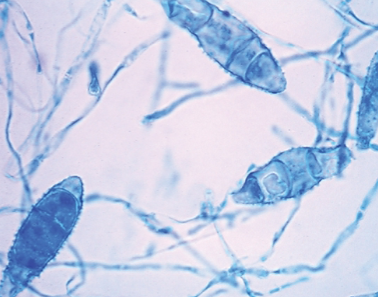 <p><span style="background-color: transparent;">from soil, a <em>macroconidia that</em> has <strong><u>rounded ends</u></strong>; </span><span>cinnamon color colonies</span><span style="background-color: transparent;"> on SDA agar</span></p>