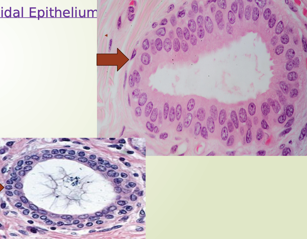 <p>What is the identification and location of the stratified cuboidal? </p>