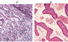 <p>Which bone tissue is developing directly from mesenchyme?</p>