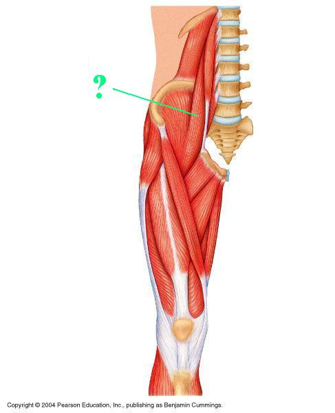 <p>Identify the indicated muscle</p>