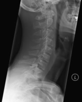 <p>what is the diagnosis?</p>