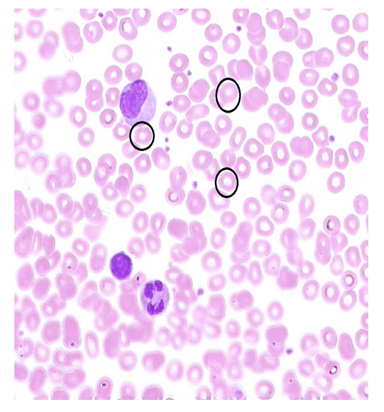 <p>What is the major protein found in this cell?</p>