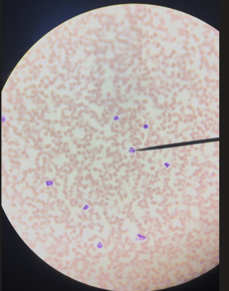 <p>What Blood Cell is on this microscope slide</p>