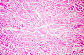 <p>which type of connective tissue is this?</p>