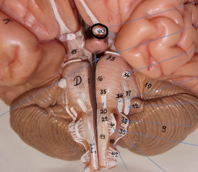 <p>Identify the circled area?</p>