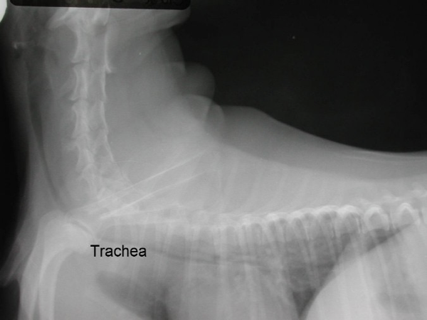 <p>Narrowing of the trachea.</p>
