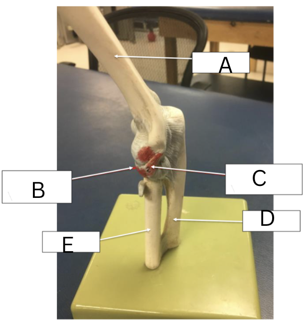 <p><span>Label the ligaments on the elbow </span></p>