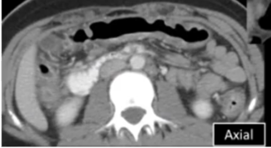 <p>diagnosis</p>
