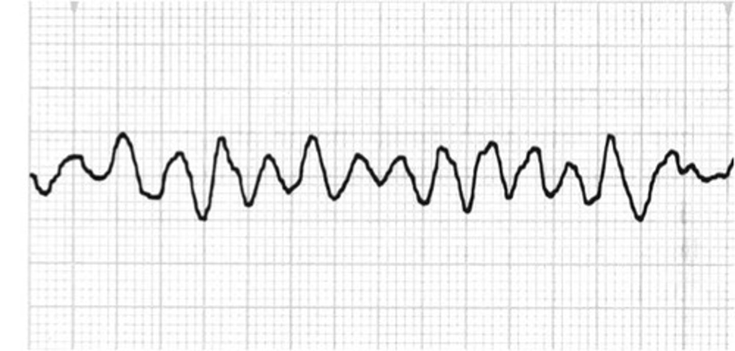 <p>Defib</p><p>CPR</p>