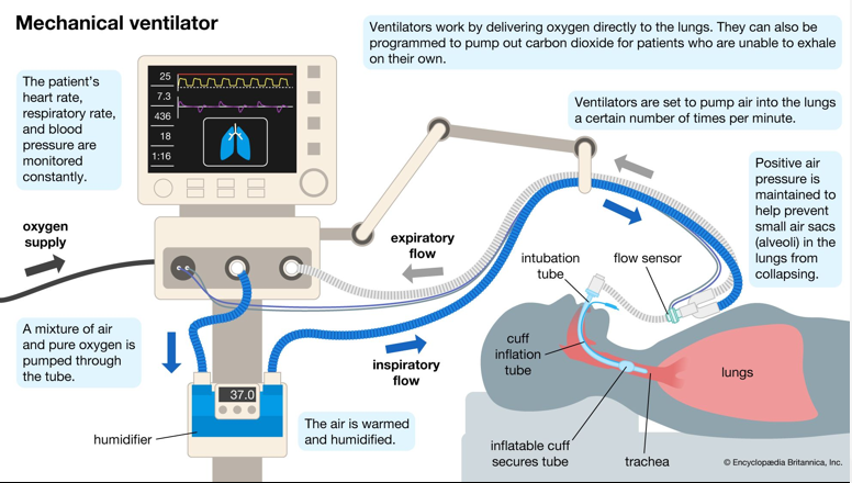 <ul><li><p>ET tube is connected to a ventilator machine; ventilator settings are adjusted to deliver oxygen and induce lung expansion/contraction to maintain O2 levels</p></li></ul><p></p>