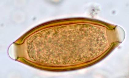 <p>thick wall, with hyaline <strong>polar plugs</strong></p>