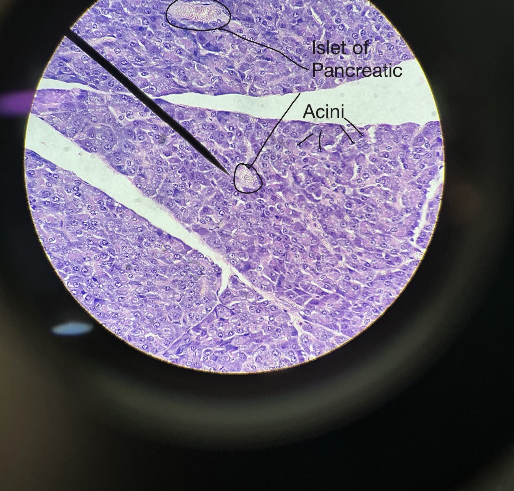 <p>-among pancreatic acini (secretory units) are pancreatic islets (lighter patches), which make insulin and glucagon</p><ul><li><p>acini:</p></li></ul><ul><li><p>Glucagon:</p></li><li><p>Insulin:</p></li></ul><p></p>