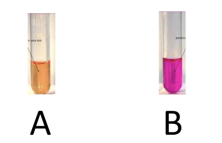 <p>Urea Hydrolysis Test</p><p>a) Medium?</p><p>b) Substrate?</p><p>c) Enzyme?</p><p>d) Indicator/Reagent?</p><p>e) End Product?</p>