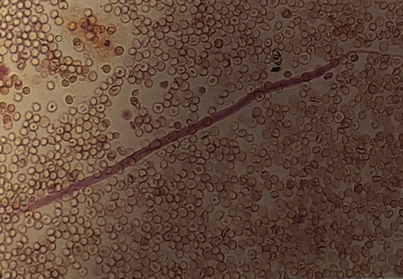 <p>What type of parasite is this?</p>