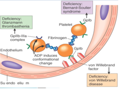 <p>Glanzmann thrombasthenia (defect in platelet aggregation due to lack of GpIIb/IIIa)</p>