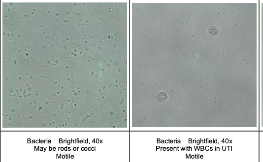<p>Bacteria: rods, cocci</p>