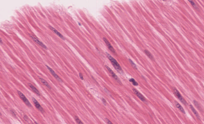 <p>what type of muscle tissue is this? </p>