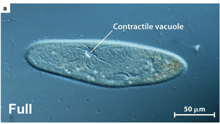 <p>Absorbs excess water in the cell and expels it to prevent cells from exploding </p>