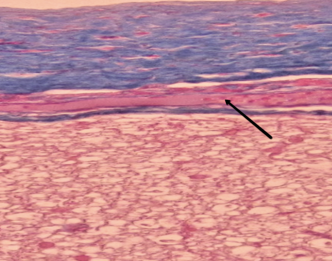 <p><span>Identify the pink structure/layer indicated by the pointer.</span></p>