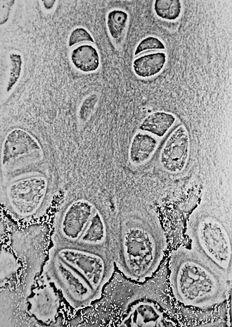 <p>Chondrocyte</p>