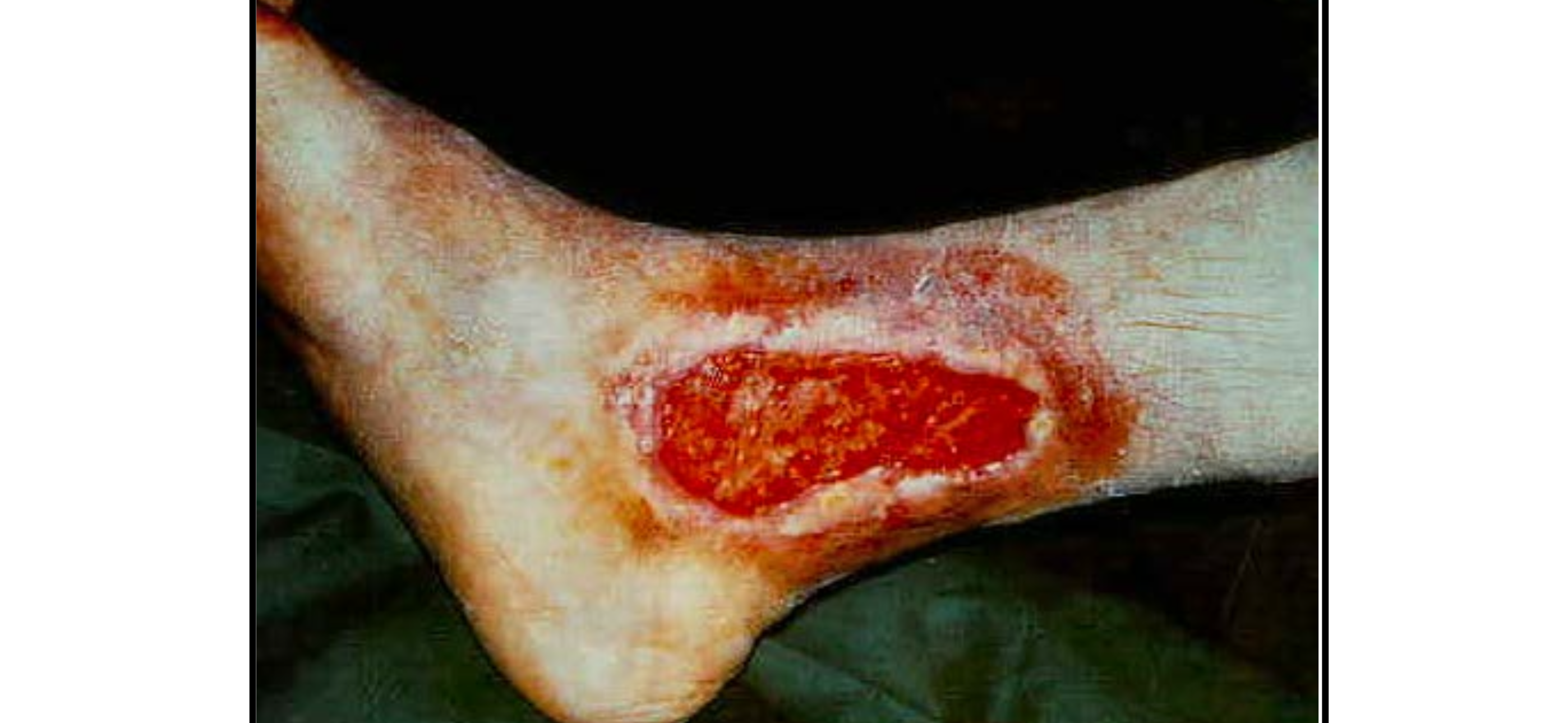 <p>Bệnh lý gì</p>