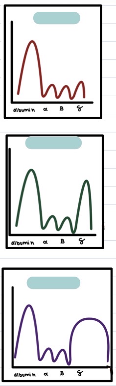 <p>Normal vs monoclonal vs polyclonal gammopathy in a printout of serum electrophoresis + why?</p>