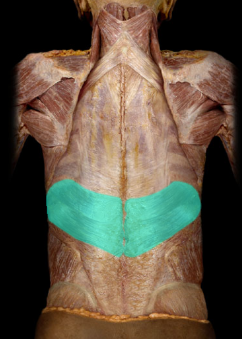 term image