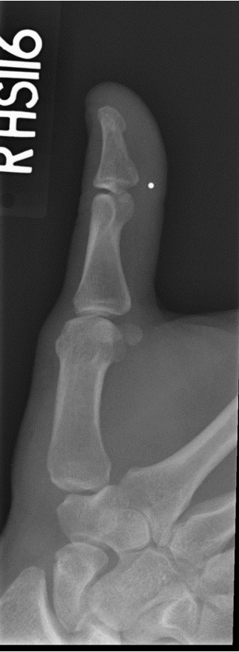 <p>Which x-ray projection + structure is shown?</p>